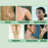 BEE VENOM VITIGO CORRECTING CREAM - (1 MONTH PACK)