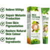 BEE VENOM VITIGO CORRECTING CREAM - (1 MONTH PACK)